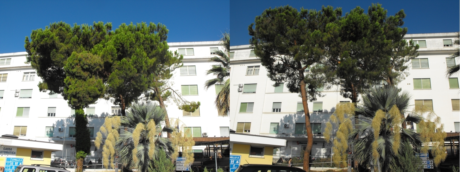 Prima e Dopo - San Benedetto del Tronto - Ospedale Civile