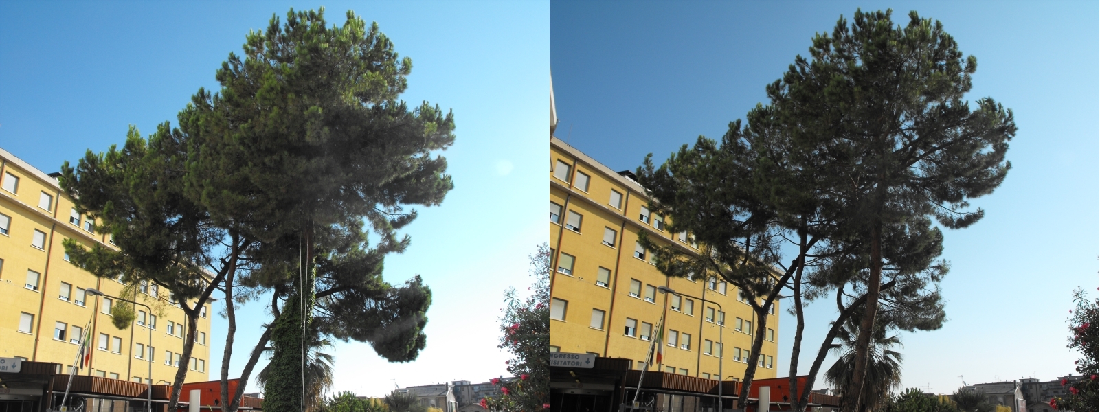 Prima e Dopo - San Benedetto del Tronto - Ospedale Civile